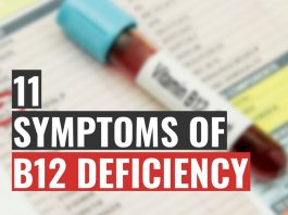 11 Symptoms of Vitamin B12 Deficiency